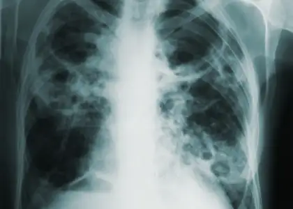 AI Revolutionizes Age Estimation and Disease Detection Header